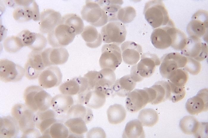 赤血球の中に入った熱帯熱マラリア原虫（輪状体）の顕微鏡写真