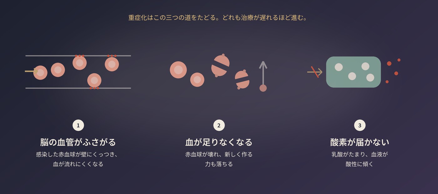 重症化の三つの道：脳の血管がふさがる、血が足りなくなる、酸素が届かない